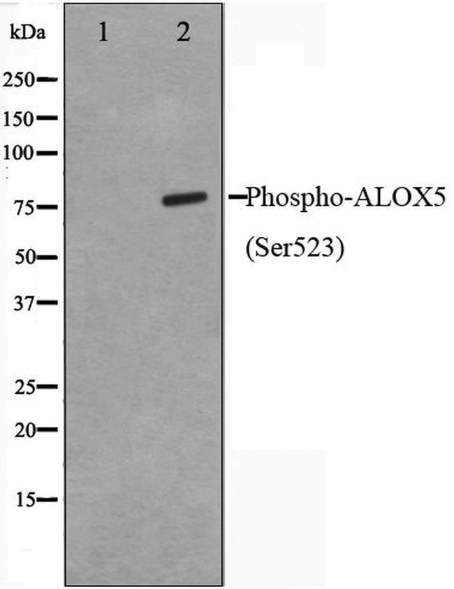 Phospho-ALOX5 (Ser523) Antibody in Western Blot (WB)