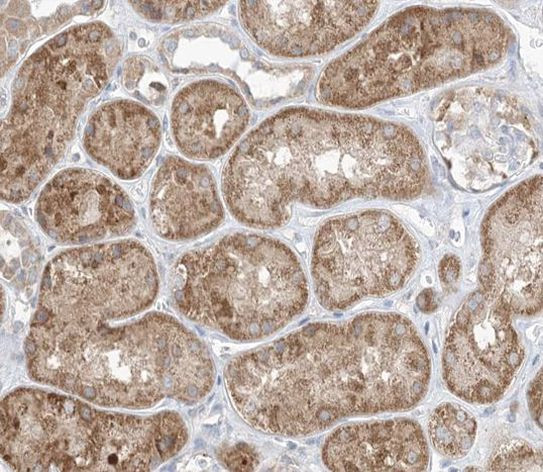 GAB2 Antibody in Immunohistochemistry (Paraffin) (IHC (P))