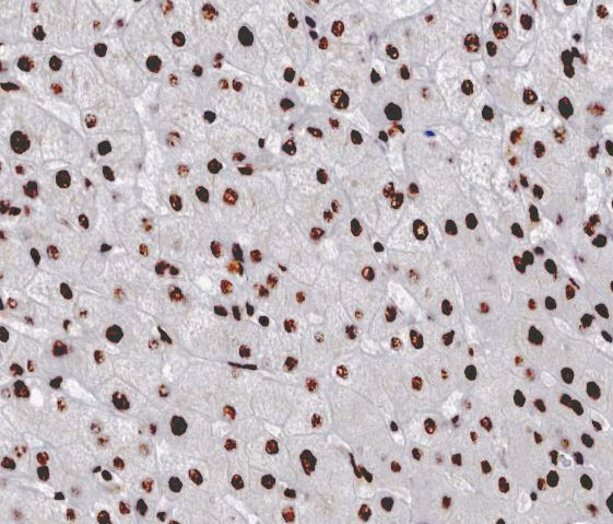 Cyclin A Antibody in Immunohistochemistry (Paraffin) (IHC (P))