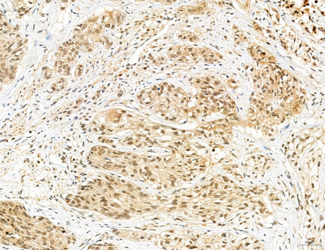 Cyclin A Antibody in Immunohistochemistry (Paraffin) (IHC (P))