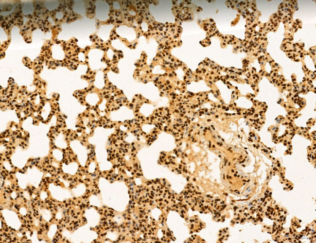 Cyclin A Antibody in Immunohistochemistry (Paraffin) (IHC (P))