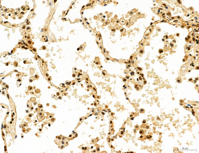 Cyclin A Antibody in Immunohistochemistry (Paraffin) (IHC (P))