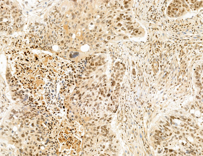 Cyclin A Antibody in Immunohistochemistry (Paraffin) (IHC (P))