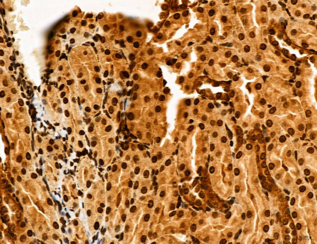 Cyclin A Antibody in Immunohistochemistry (Paraffin) (IHC (P))