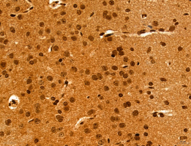 Cyclin A Antibody in Immunohistochemistry (Paraffin) (IHC (P))