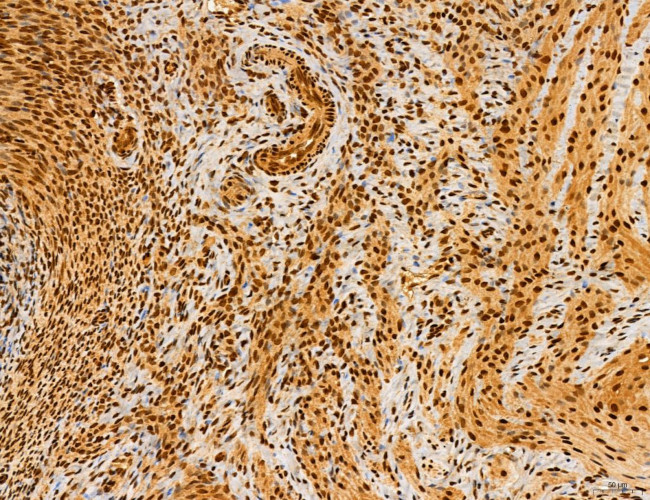 Cyclin A Antibody in Immunohistochemistry (Paraffin) (IHC (P))