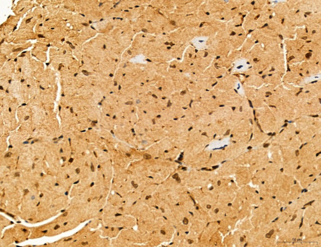 Cyclin A Antibody in Immunohistochemistry (Paraffin) (IHC (P))