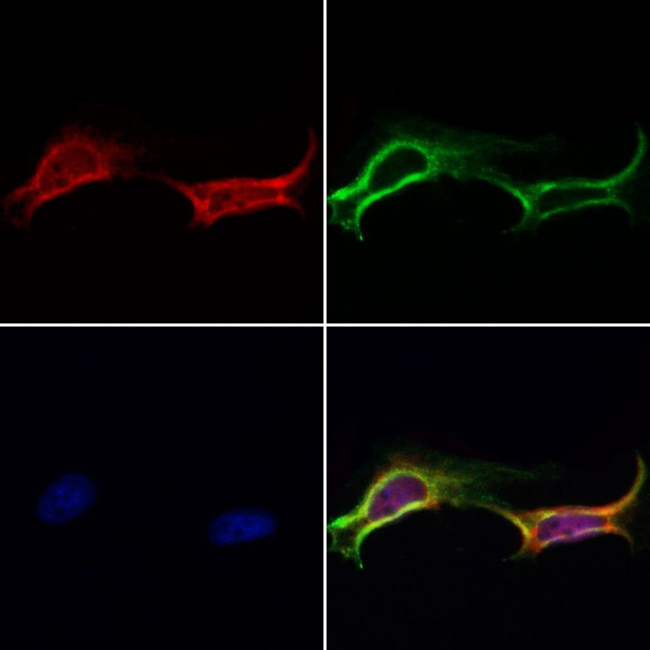 DNA Polymerase beta Antibody in Immunocytochemistry (ICC/IF)