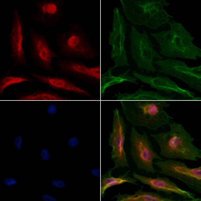 DNA Polymerase beta Antibody in Immunocytochemistry (ICC/IF)