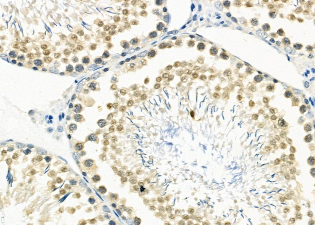 DP1 Antibody in Immunohistochemistry (Paraffin) (IHC (P))