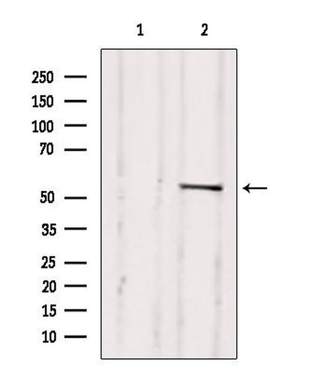 DP1 Antibody in Western Blot (WB)