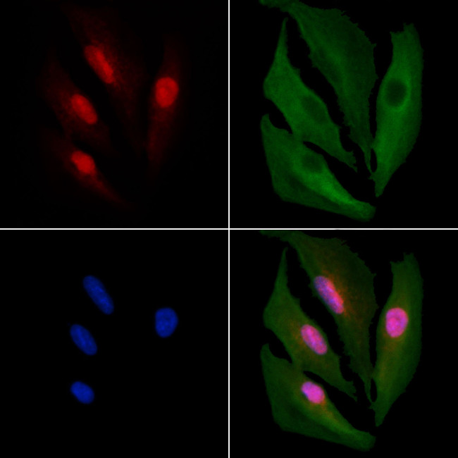 E2F4 Antibody in Immunocytochemistry (ICC/IF)