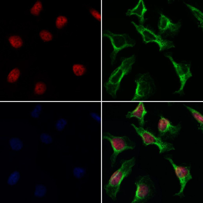 E2F4 Antibody in Immunocytochemistry (ICC/IF)