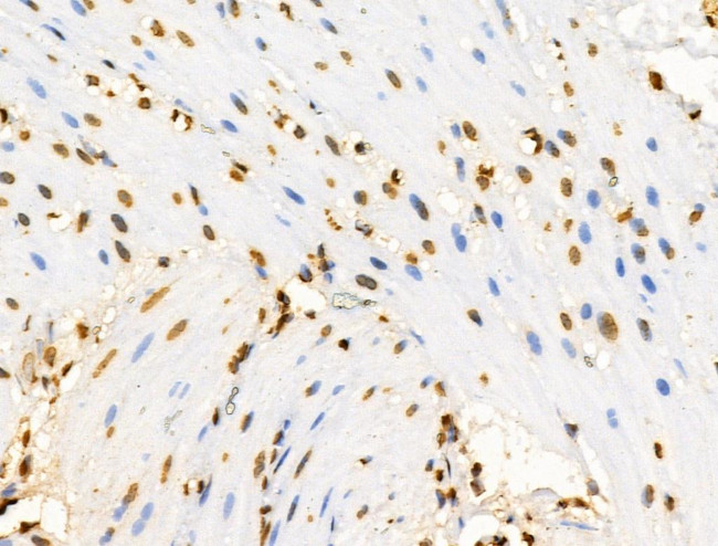 E2F4 Antibody in Immunohistochemistry (Paraffin) (IHC (P))