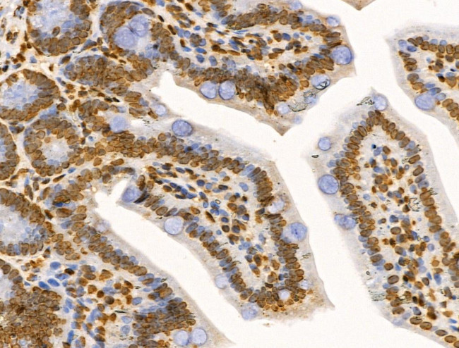 E2F4 Antibody in Immunohistochemistry (Paraffin) (IHC (P))