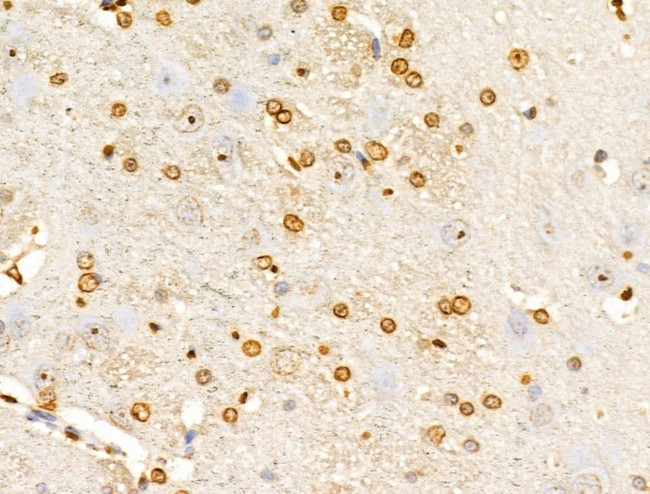 E2F4 Antibody in Immunohistochemistry (Paraffin) (IHC (P))