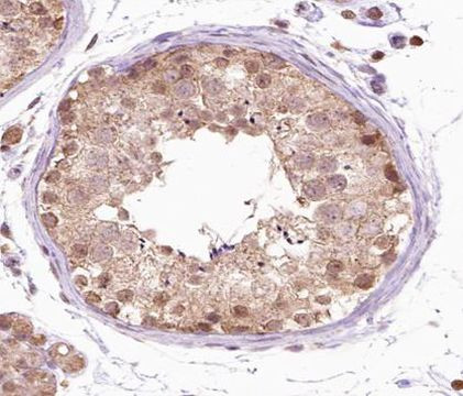 FGFR1OP Antibody in Immunohistochemistry (Paraffin) (IHC (P))