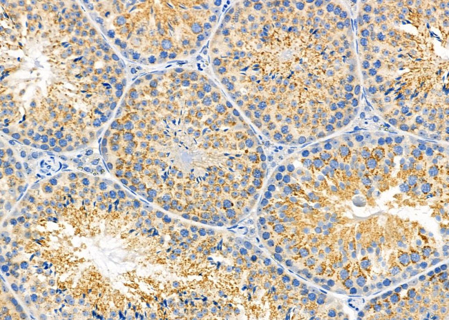 FGFR1OP Antibody in Immunohistochemistry (Paraffin) (IHC (P))