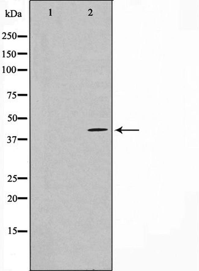 FGFR1OP Antibody in Western Blot (WB)