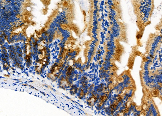 HSPE1 Antibody in Immunohistochemistry (Paraffin) (IHC (P))