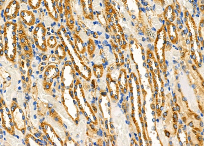 HSPE1 Antibody in Immunohistochemistry (Paraffin) (IHC (P))