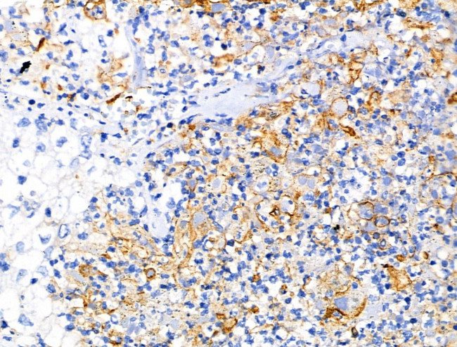 Mammaglobin B Antibody in Immunohistochemistry (Paraffin) (IHC (P))