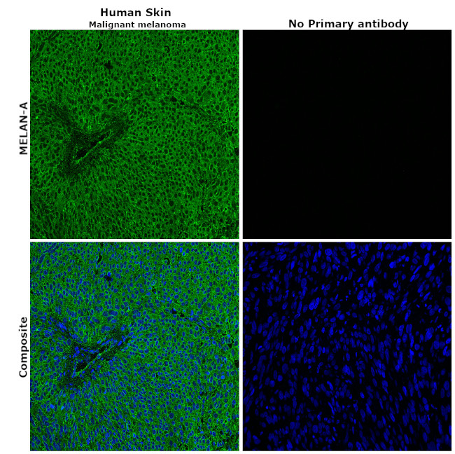 Melan-A Antibody in Immunohistochemistry (Paraffin) (IHC (P))