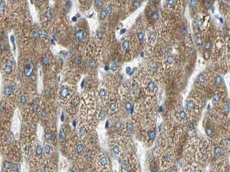 MMP11 Antibody in Immunohistochemistry (Paraffin) (IHC (P))