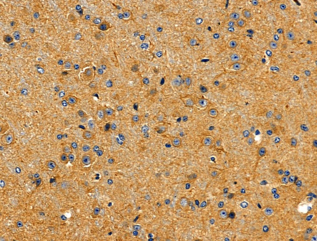 SIRP alpha Antibody in Immunohistochemistry (Paraffin) (IHC (P))