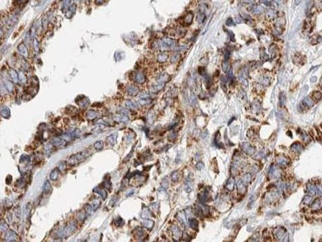 gamma Synuclein Antibody in Immunohistochemistry (Paraffin) (IHC (P))