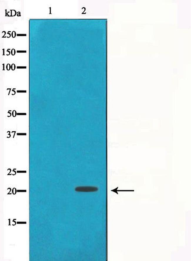 gamma Synuclein Antibody in Western Blot (WB)