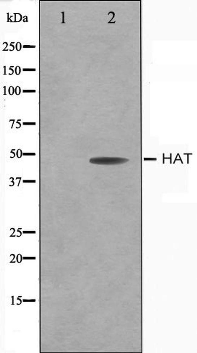 HAT1 Antibody in Western Blot (WB)