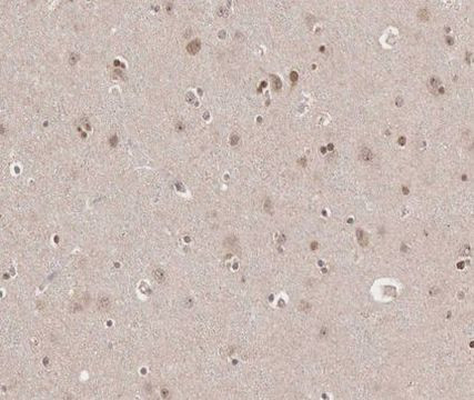 TRADD Antibody in Immunohistochemistry (Paraffin) (IHC (P))