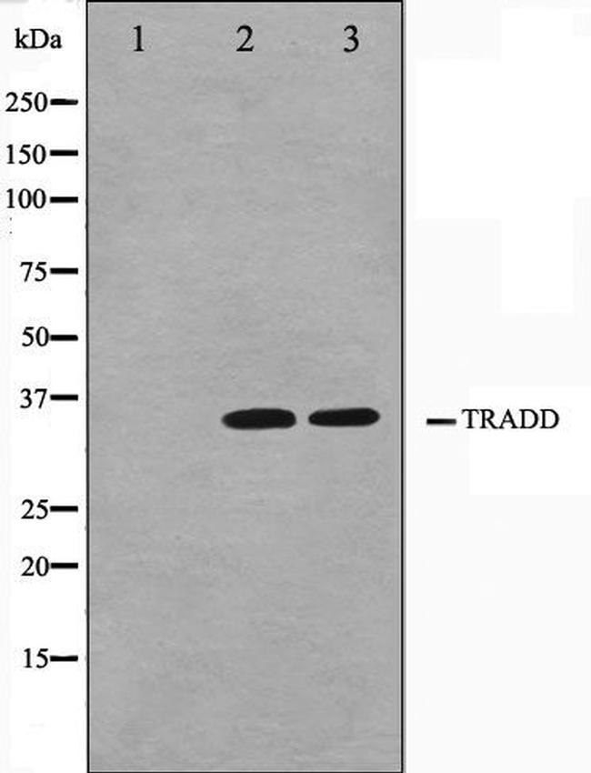 TRADD Antibody in Western Blot (WB)