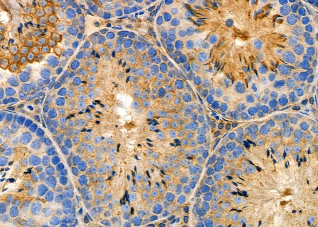 TRIM38 Antibody in Immunohistochemistry (Paraffin) (IHC (P))