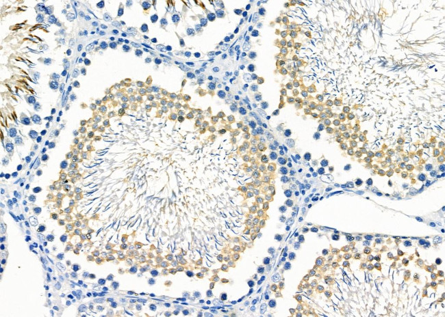 TRIM38 Antibody in Immunohistochemistry (Paraffin) (IHC (P))