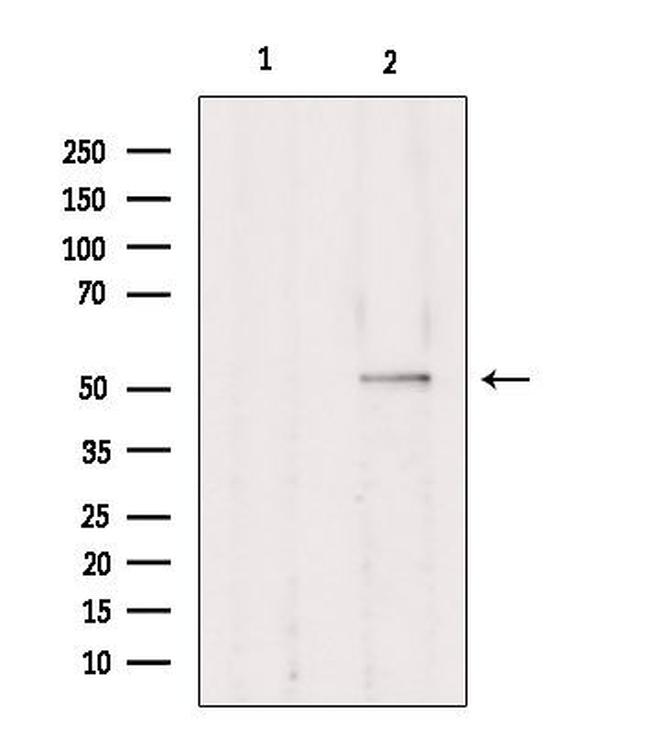 TRIM38 Antibody in Western Blot (WB)