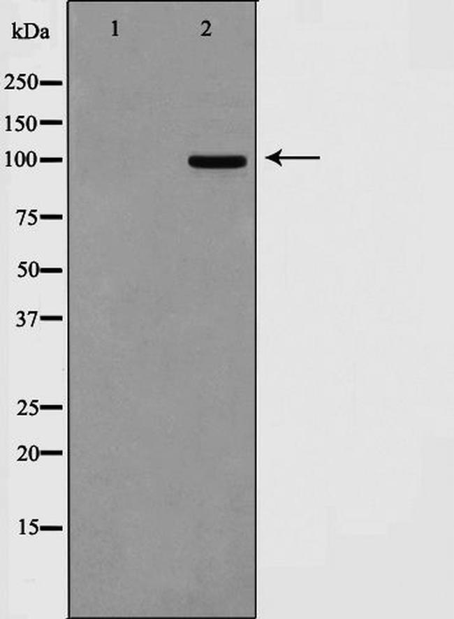 SAPAP1 Antibody in Western Blot (WB)