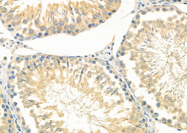 GAK Antibody in Immunohistochemistry (Paraffin) (IHC (P))