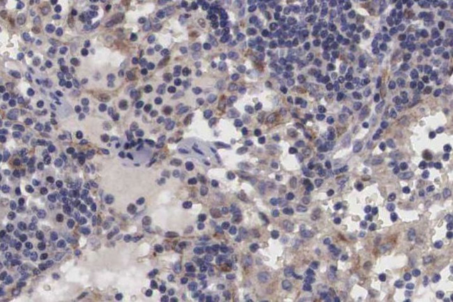 TRIM24 Antibody in Immunohistochemistry (Paraffin) (IHC (P))