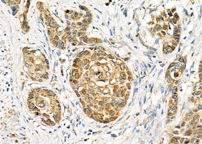 TRIM24 Antibody in Immunohistochemistry (Paraffin) (IHC (P))