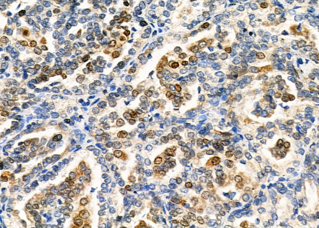 TRIM24 Antibody in Immunohistochemistry (Paraffin) (IHC (P))