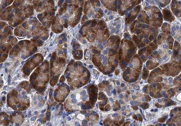 TWEAK Antibody in Immunohistochemistry (Paraffin) (IHC (P))