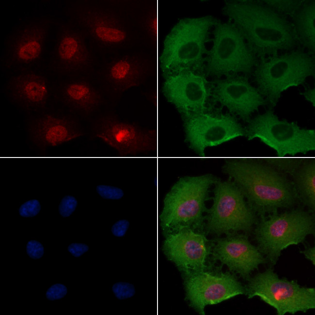 TAF5L Antibody in Immunocytochemistry (ICC/IF)