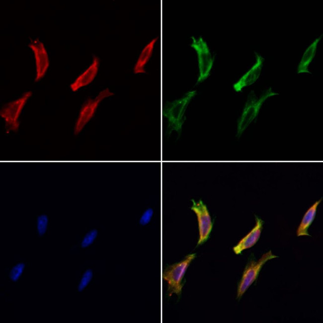 MOS Antibody in Immunocytochemistry (ICC/IF)