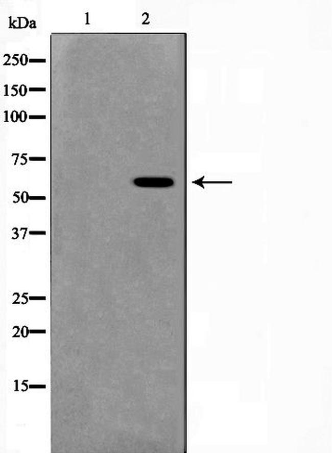 MUTYH Antibody in Western Blot (WB)