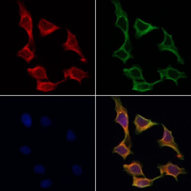 ABCF1 Antibody in Immunocytochemistry (ICC/IF)