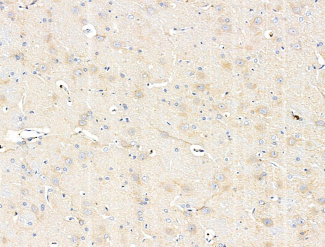 ABCF1 Antibody in Immunohistochemistry (Paraffin) (IHC (P))