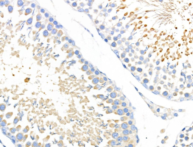 ABCF1 Antibody in Immunohistochemistry (Paraffin) (IHC (P))