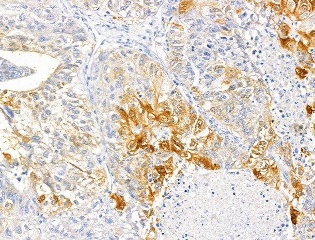 ABCF1 Antibody in Immunohistochemistry (Paraffin) (IHC (P))